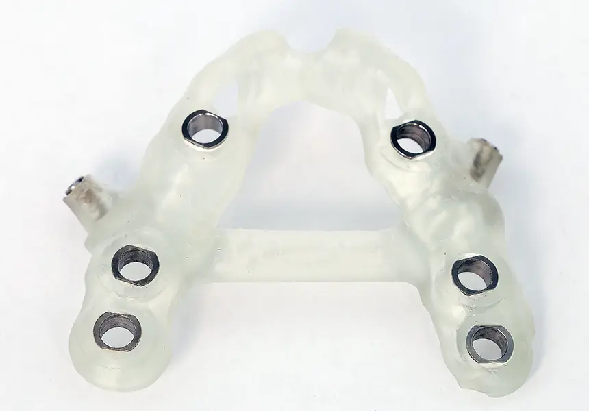 サージカルガイドを用いた手術